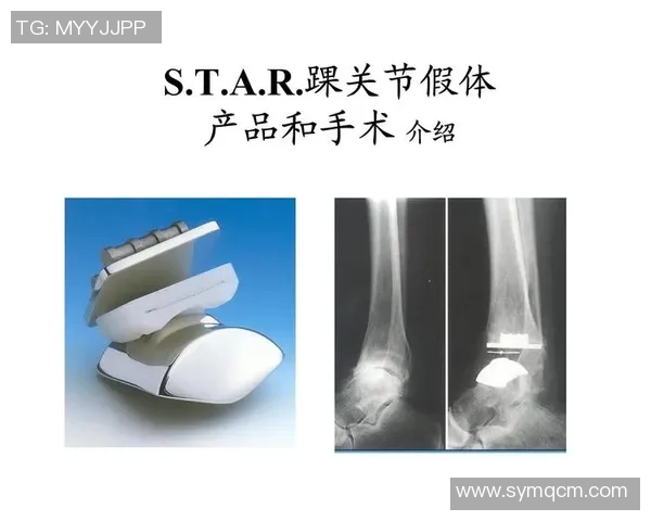 足球明星踝关节置换手术背后的故事与康复之路探秘